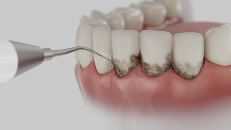 Reliable Tooth Extraction contractor in Artesia, CA by Smile Center Dentistry